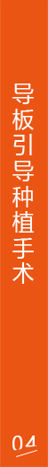 导板引导种植手术